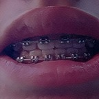 Onlyfans leaked bracesfetish 

 profile picture