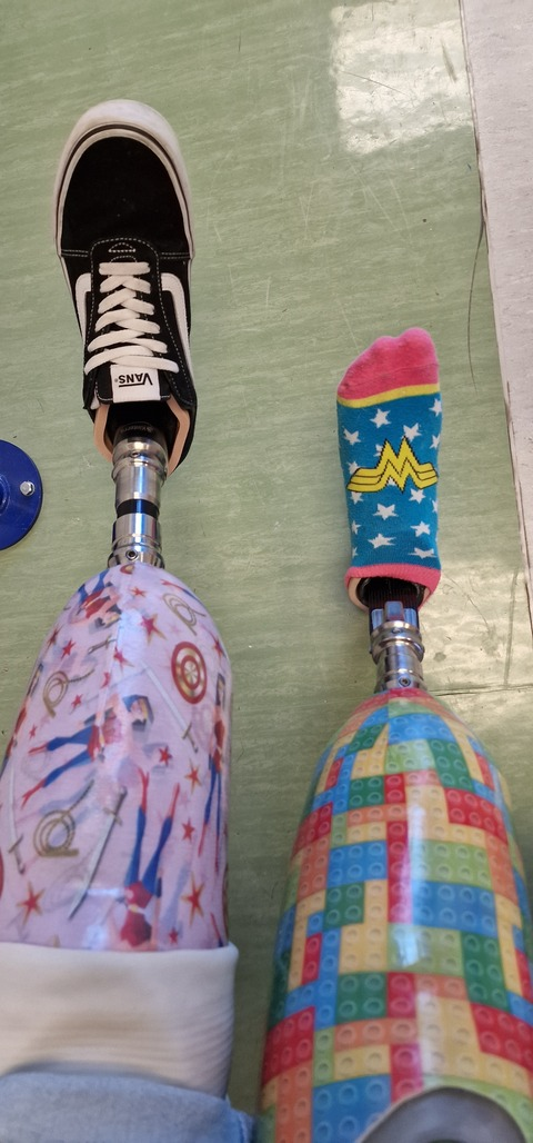 Video leaks female-amputee