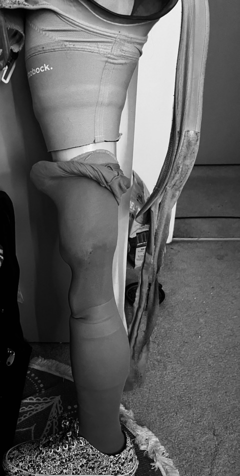 Video leaks oneleggedqueen