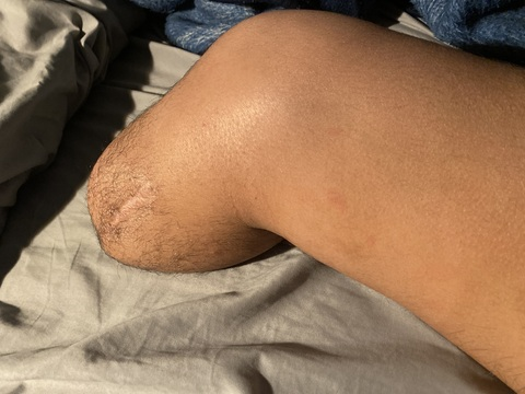 Video leaks strongamputee Video leaks strongamputee